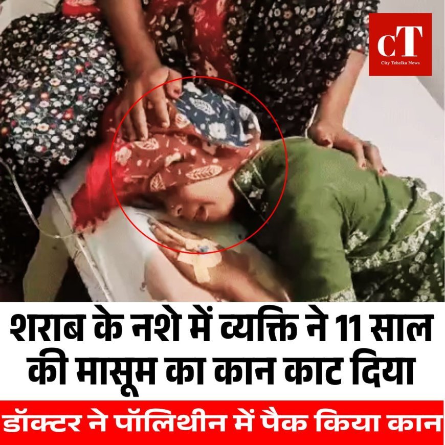 शराब के नशे में व्यक्ति ने 11 साल की मासूम का कान काट दिया,बच्चों के बीच हुई थी कहासुनी