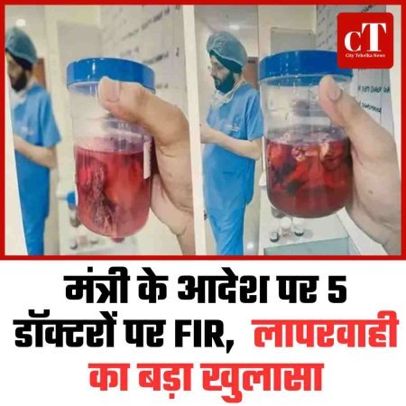मंत्री के आदेश पर 5 डॉक्टरों पर FIR,  लापरवाही का बड़ा खुलासा