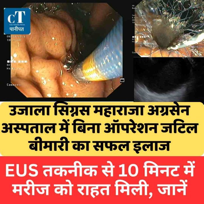 उजाला सिग्नस महाराजा अग्रसेन अस्पताल में बिना ऑपरेशन जटिल बीमारी का सफल इलाज, EUS तकनीक से 10 मिनट में मरीज को राहत मिली, जानें