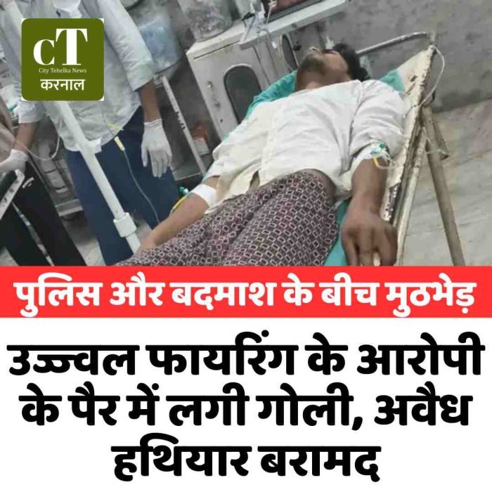 पुलिस और बदमाश के बीच मुठभेड़:उज्ज्वल फायरिंग के आरोपी के पैर में लगी गोली, अवैध हथियार बरामद