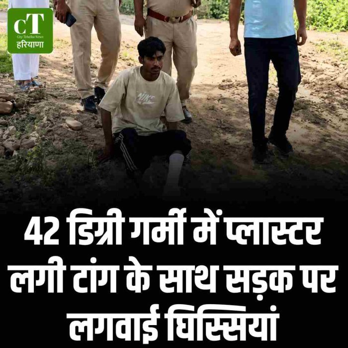 42 डिग्री गर्मी में प्लास्टर लगी टांग के साथ सड़क पर लगवाई घिस्सियां