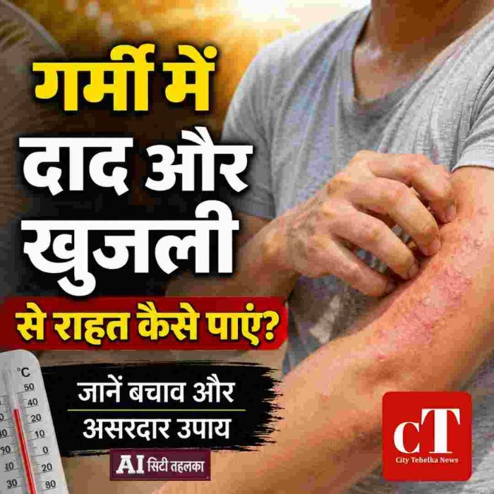 गर्मी में दाद, खुजली और फंगल इंफेक्शन की समस्या तेजी से बढ़ती है