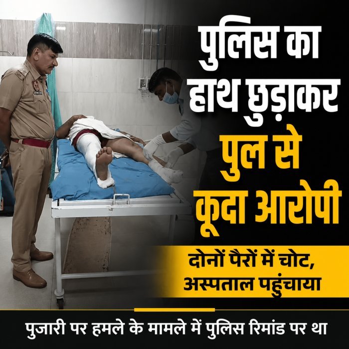 मंदिर में घुस पुजारी की तोड़ी थी टांग तोड़ने के आरोपी ने पुलिस कस्‍टडी से भागने की कोशिश की, पुल से कूदा टांग टूटी