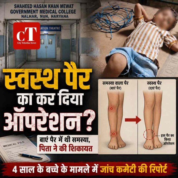 दिक्‍कत थी बाएं पैर में आपरेश्‍न कर दिया दाएं का,  मेडिकल कालेज का कारनामा