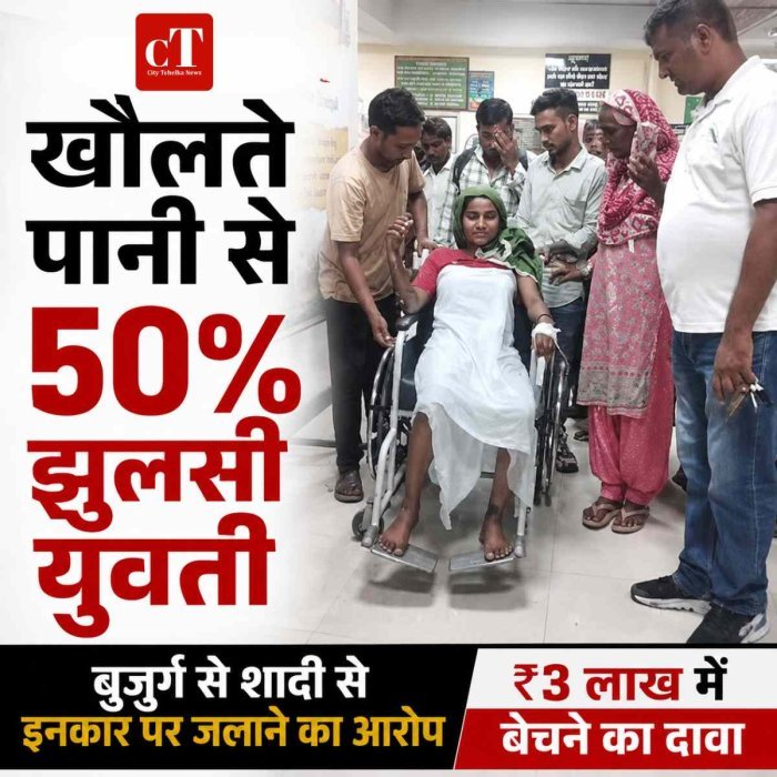 हैवानियत:  बुजुर्ग से शादी से इंकार किया तो युवती पर खौलता पानी डालने का आरोप, 50% झुलसी