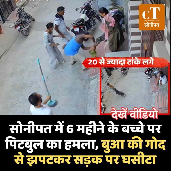 सोनीपत में 6 महीने के बच्चे पर पिटबुल का हमला, बुआ की गोद से झपटकर सड़क पर घसीटा; 20 से ज्यादा टांके लगे