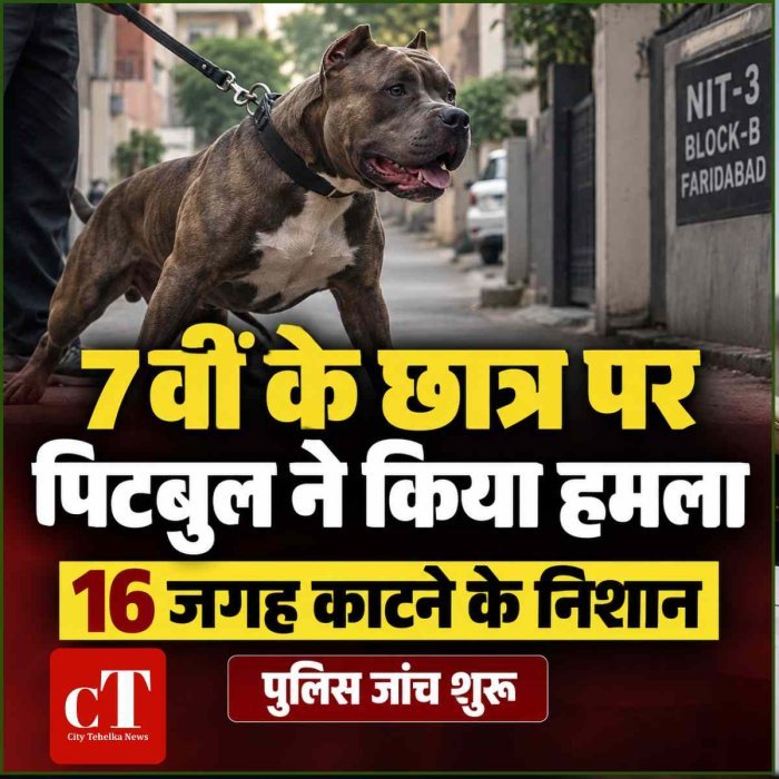 पिटबुल का 7वीं के छात्र पर हमला, शरीर पर 16 जगह काटने के निशान; पुलिस जांच शुरू